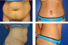 before and after photos